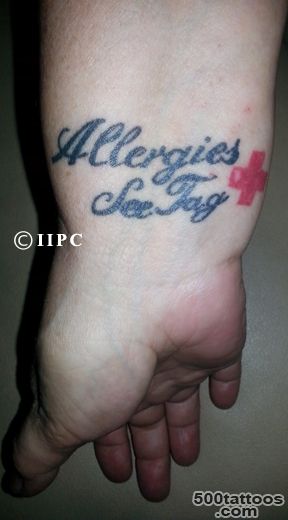 Medical Tattoos, The New Trend ©  League of Permanent Cosmetic ..._12
