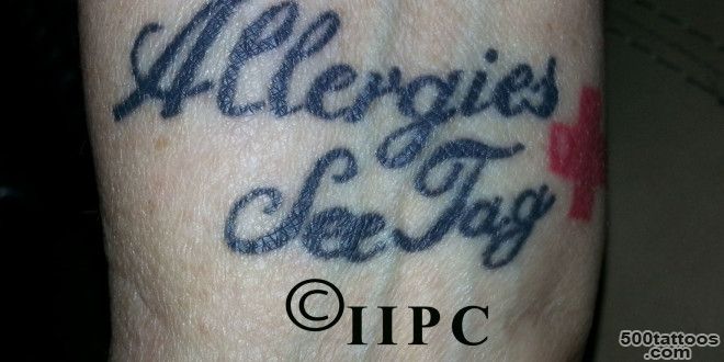 Medical Tattoos, The New Trend ©  League of Permanent Cosmetic ..._35