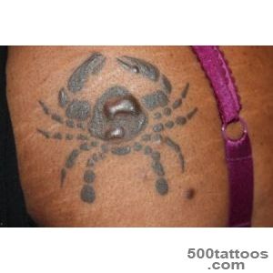 Tattoo medical issues   Wikipedia, the free encyclopedia_45JPG