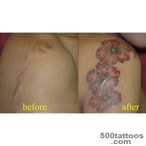 20 Shockingly Amazing Scar Tattoos   Page 16 of 20 (20 Images)_3