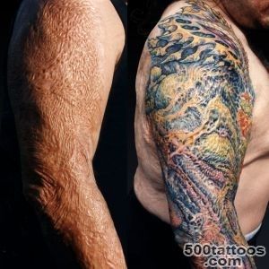 Ask Guy What about this scar Tattoo Education_23