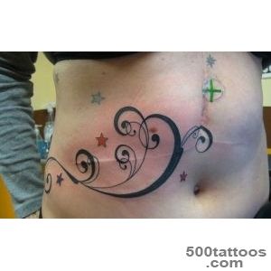 Can you tattoo over my scarstretch marks Well  TAM Blog_40