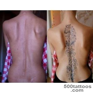 scoliosis+scar+cover+up+tattoos  Scoliosis Surgery Scar Tattoo _8