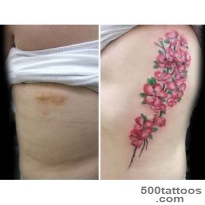 These Beautiful Tattoos Helped People Cover Their Haunting Scars_10