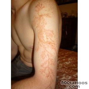 This man was struck by lightening and the scar is amazing, albeit _18