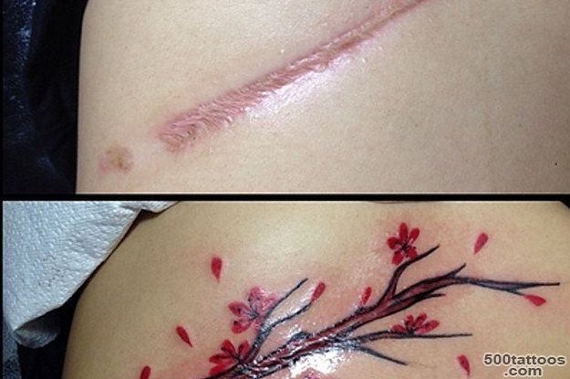 21 Amazing Tattoos That Have Done An Incredible Job Covering Up Scars_15