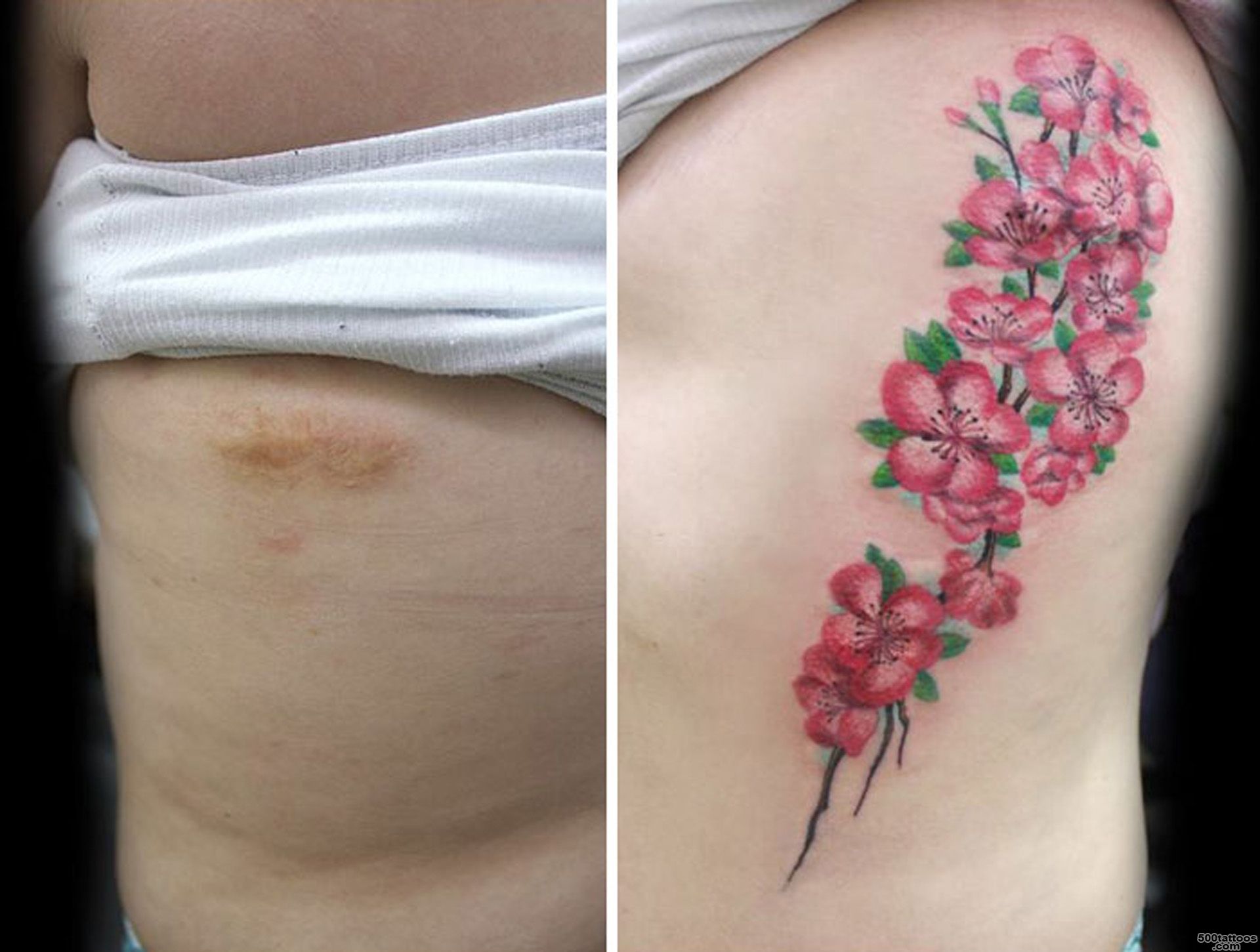 These Beautiful Tattoos Helped People Cover Their Haunting Scars_10