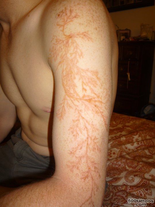 This man was struck by lightening and the scar is amazing, albeit ..._18