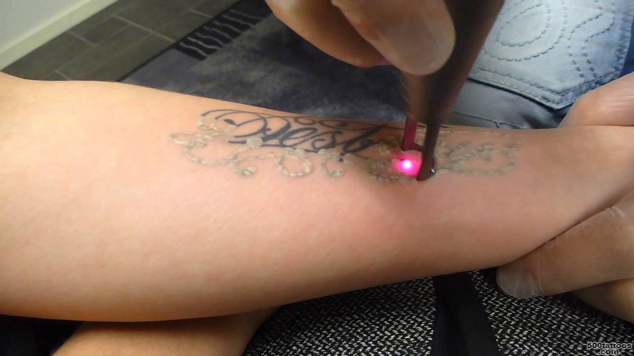 Tattoo removal black text forearm   YouTube_20